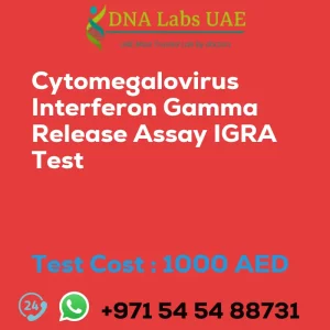 Cytomegalovirus Interferon Gamma Release Assay IGRA Test sale cost 1000 AED