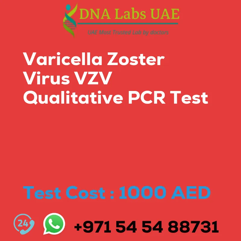 Varicella Zoster Virus VZV Qualitative PCR Test sale cost 1000 AED