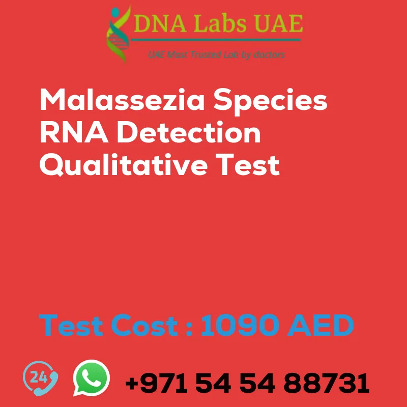 Malassezia Species RNA Detection Qualitative Test sale cost 1090 AED