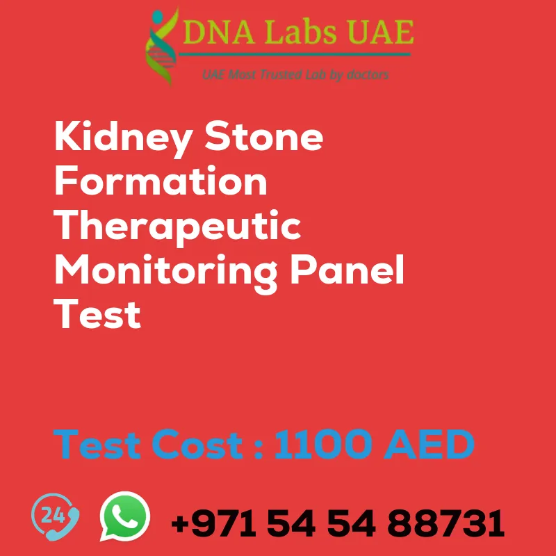 Kidney Stone Formation Therapeutic Monitoring Panel Test sale cost 1100 AED
