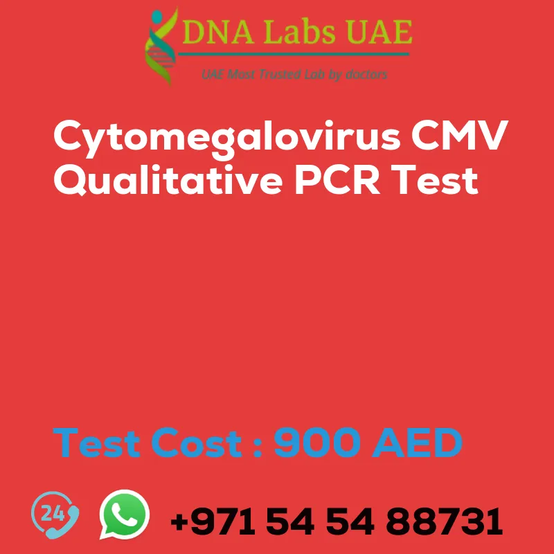 Cytomegalovirus CMV Qualitative PCR Test sale cost 900 AED