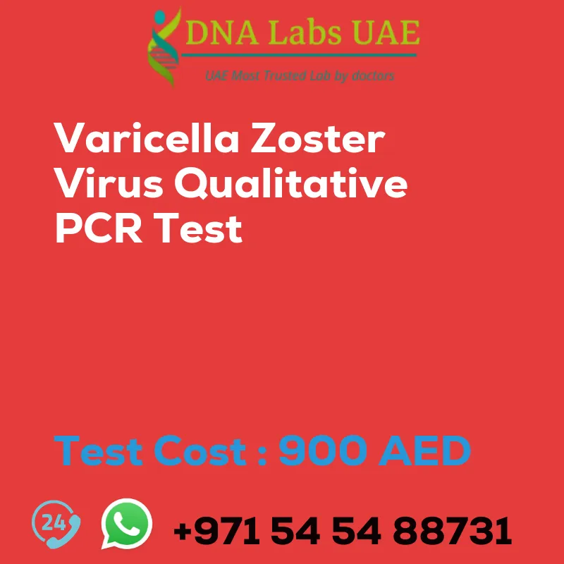 Varicella Zoster Virus Qualitative PCR Test sale cost 900 AED