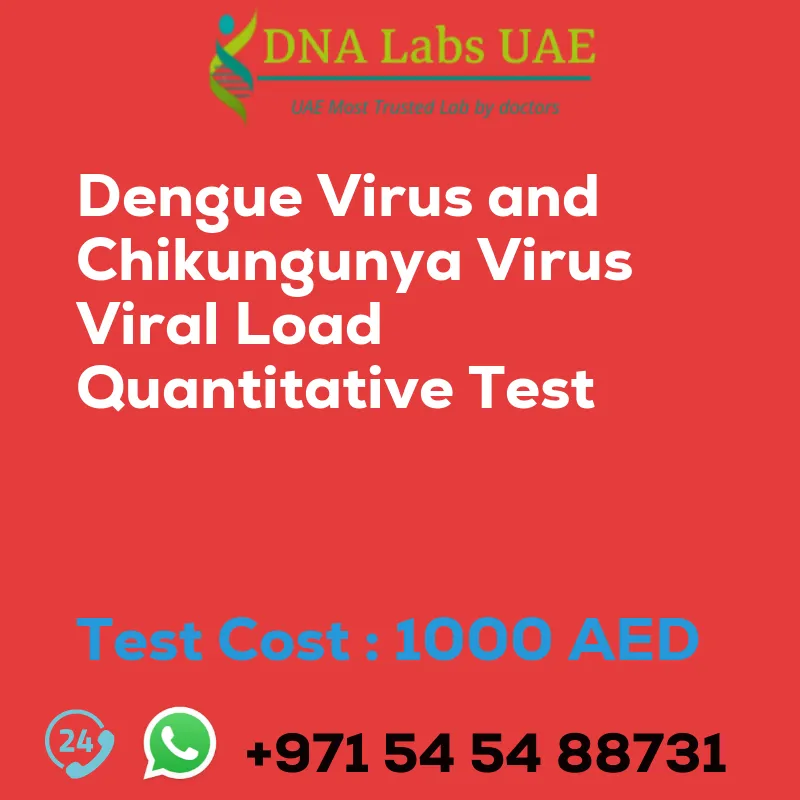 Dengue Virus and Chikungunya Virus Viral Load Quantitative Test sale cost 1000 AED