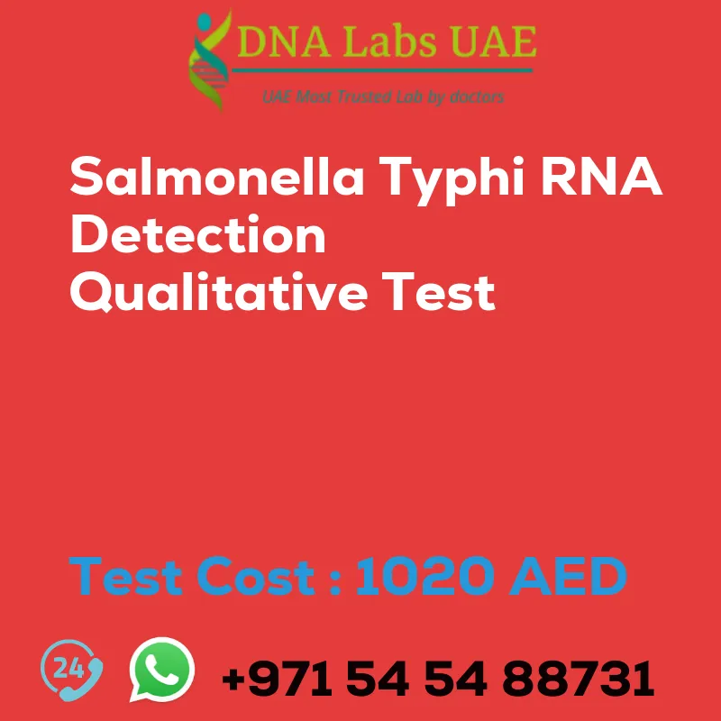 Salmonella Typhi RNA Detection Qualitative Test sale cost 1020 AED