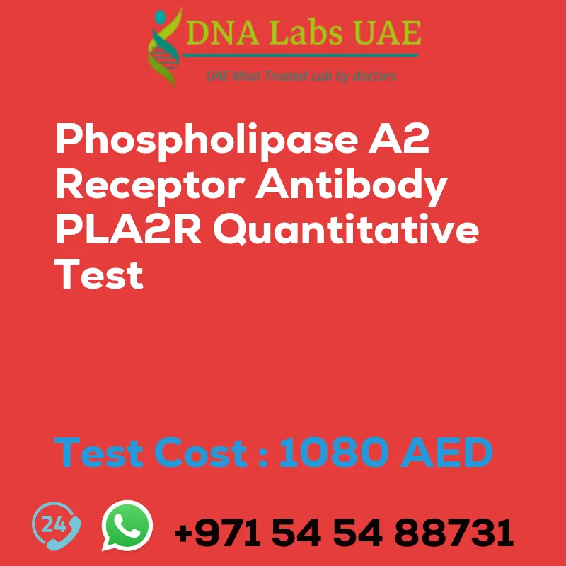Phospholipase A2 Receptor Antibody PLA2R Quantitative Test sale cost 1080 AED