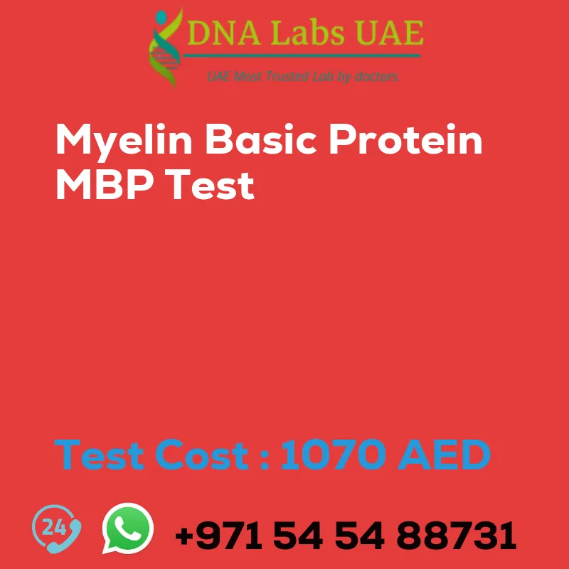 Myelin Basic Protein MBP Test sale cost 1070 AED