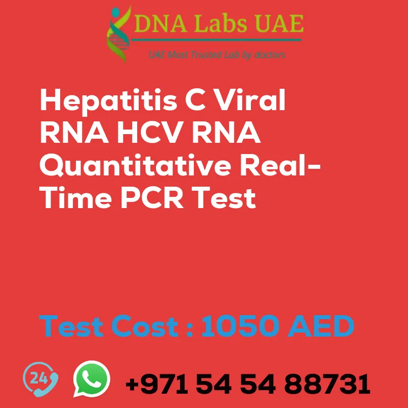 Hepatitis C Viral RNA HCV RNA Quantitative Real-Time PCR Test sale cost 1050 AED