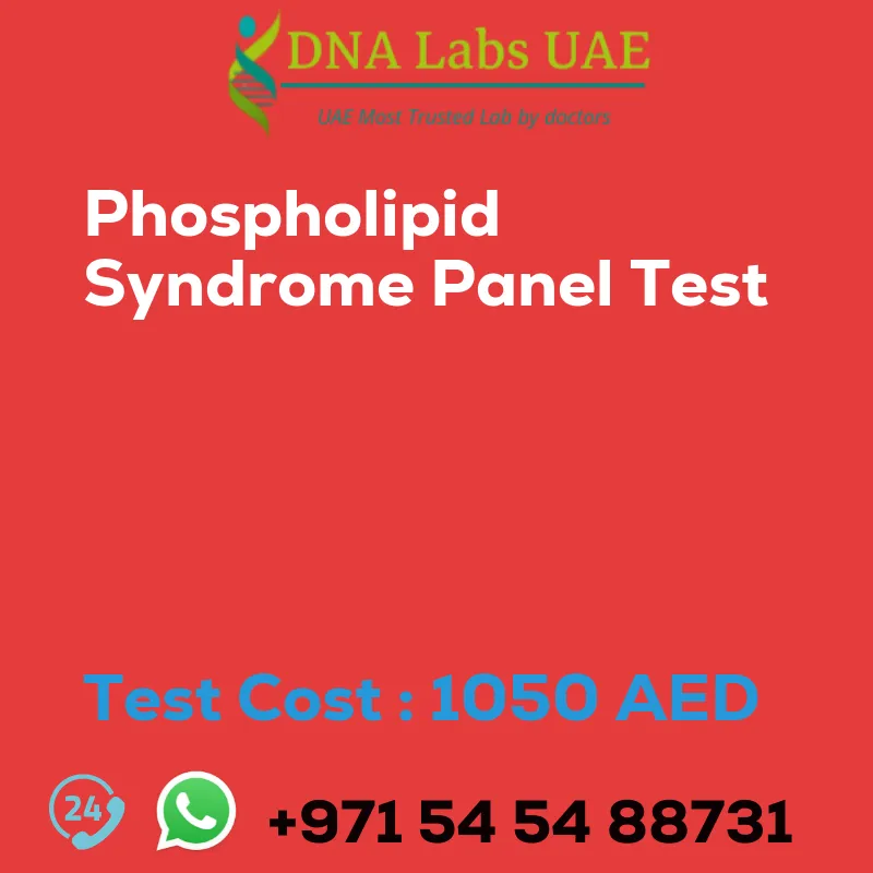 Phospholipid Syndrome Panel Test sale cost 1050 AED