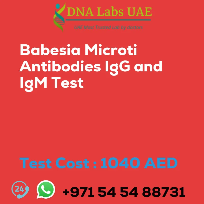 Babesia Microti Antibodies IgG and IgM Test sale cost 1040 AED