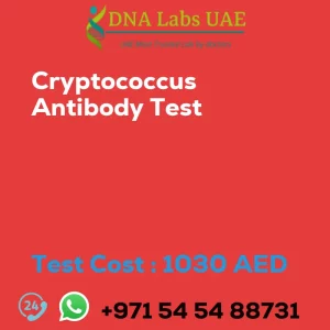Cryptococcus Antibody Test sale cost 1030 AED