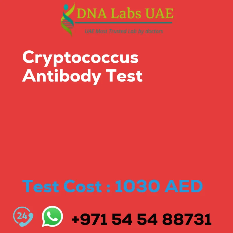 Cryptococcus Antibody Test sale cost 1030 AED