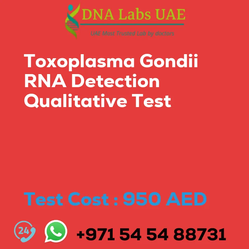 Toxoplasma Gondii RNA Detection Qualitative Test sale cost 950 AED