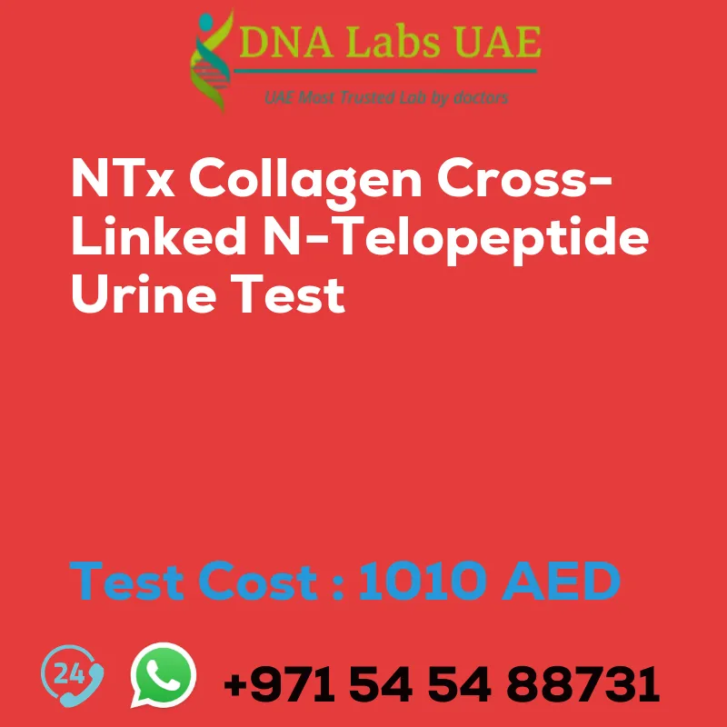 NTx Collagen Cross-Linked N-Telopeptide Urine Test sale cost 1010 AED