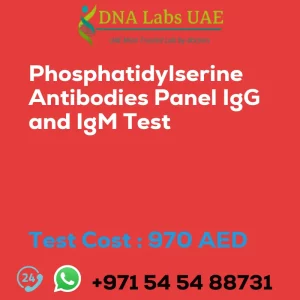Phosphatidylserine Antibodies Panel IgG and IgM Test sale cost 970 AED
