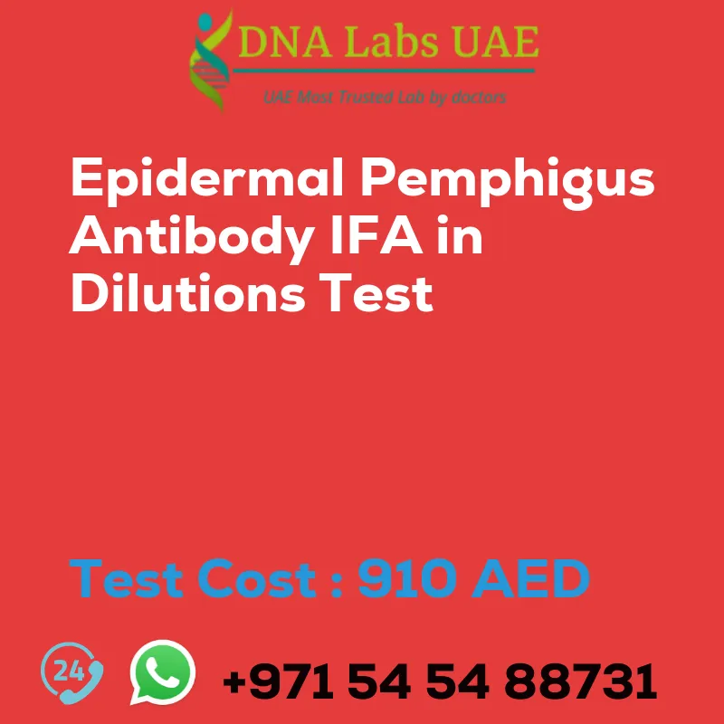 Epidermal Pemphigus Antibody IFA in Dilutions Test sale cost 910 AED