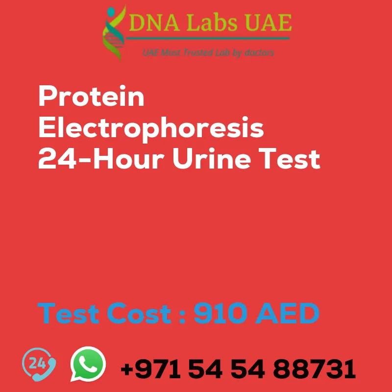 Protein Electrophoresis 24-Hour Urine Test sale cost 910 AED