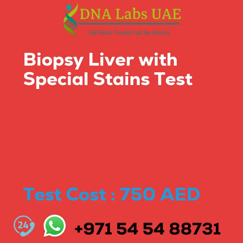 Biopsy Liver with Special Stains Test sale cost 750 AED