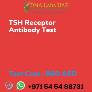 TSH Receptor Antibody Test sale cost 880 AED