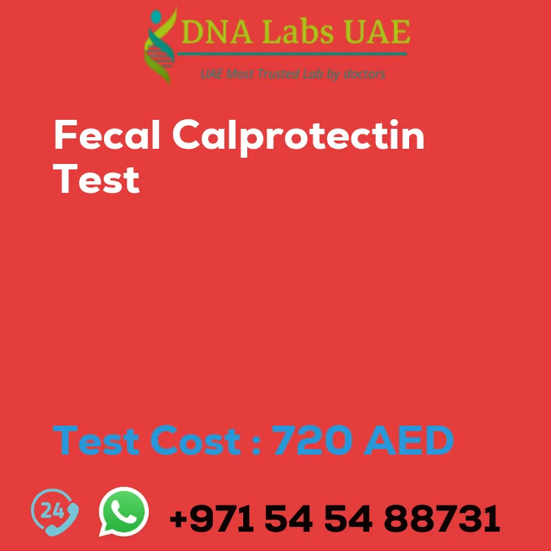 Fecal Calprotectin Test sale cost 720 AED