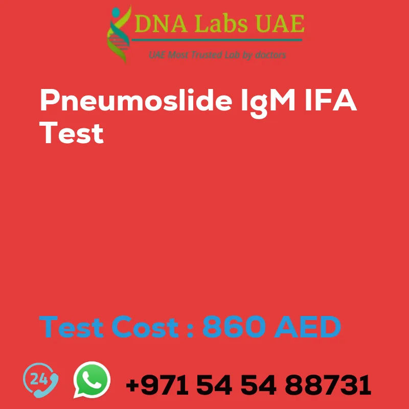 Pneumoslide IgM IFA Test sale cost 860 AED