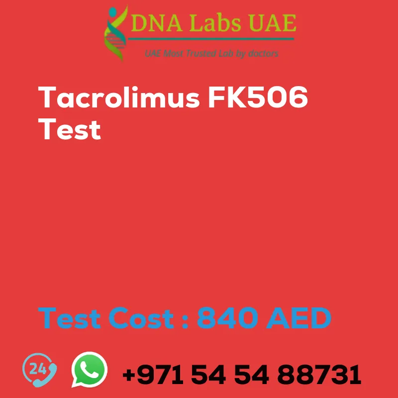 Tacrolimus FK506 Test sale cost 840 AED