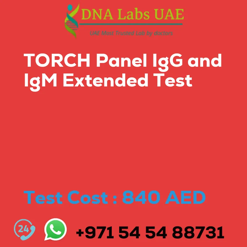 TORCH Panel IgG and IgM Extended Test sale cost 840 AED