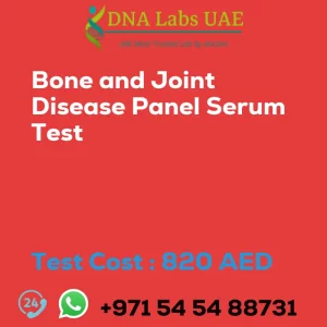 Bone and Joint Disease Panel Serum Test sale cost 820 AED