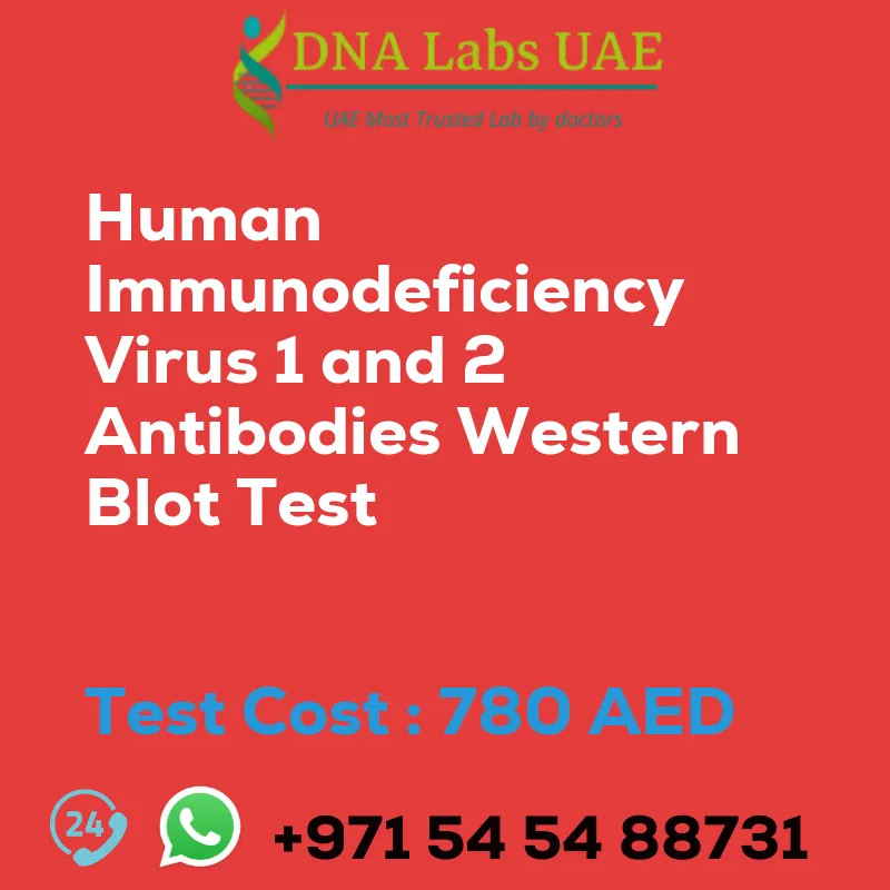 Human Immunodeficiency Virus 1 and 2 Antibodies Western Blot Test sale cost 780 AED