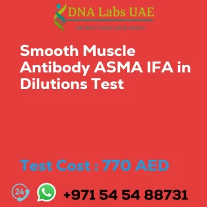 Smooth Muscle Antibody ASMA IFA in Dilutions Test sale cost 770 AED