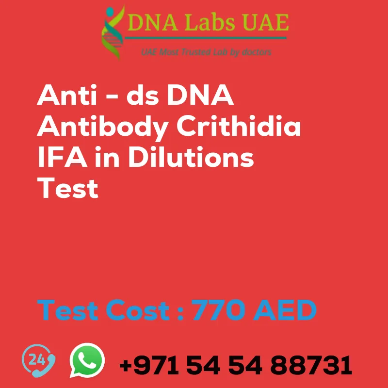 Anti - ds DNA Antibody Crithidia IFA in Dilutions Test sale cost 770 AED