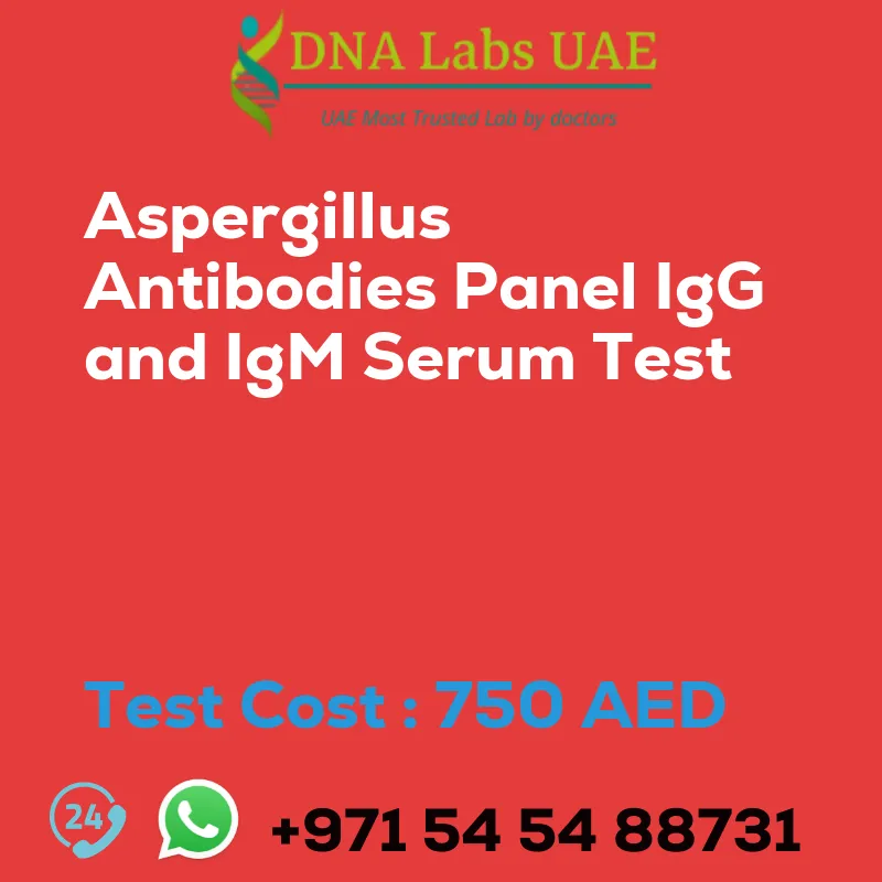 Aspergillus Antibodies Panel IgG and IgM Serum Test sale cost 750 AED