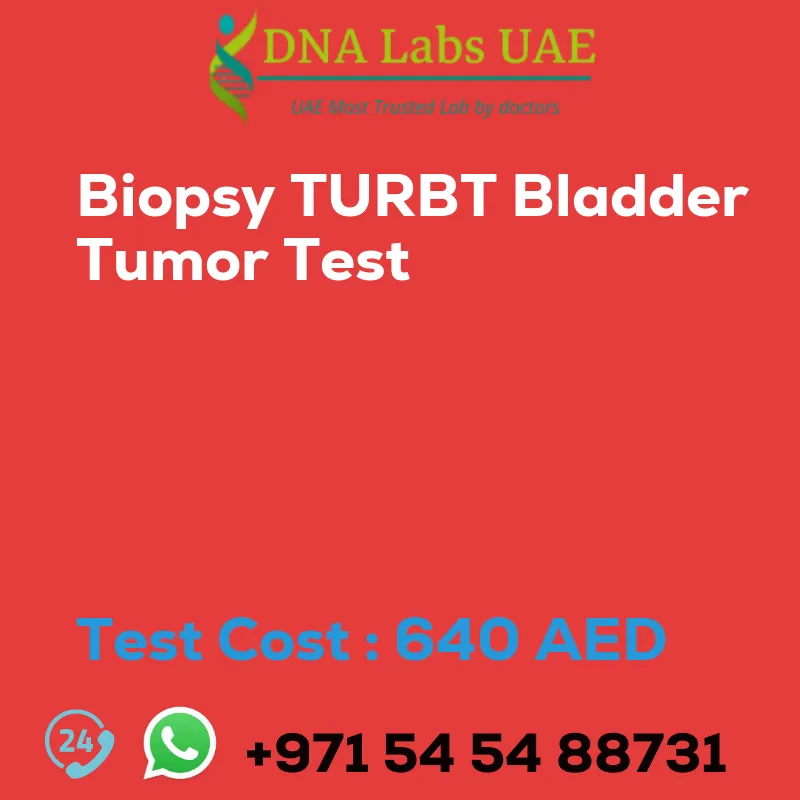 Biopsy TURBT Bladder Tumor Test sale cost 640 AED