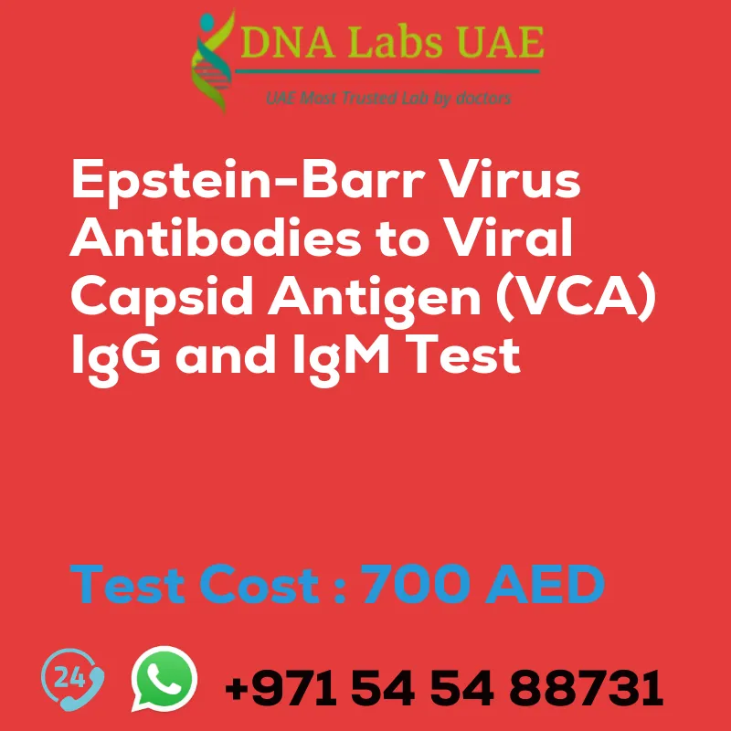 Epstein-Barr Virus Antibodies to Viral Capsid Antigen (VCA) IgG and IgM Test sale cost 700 AED