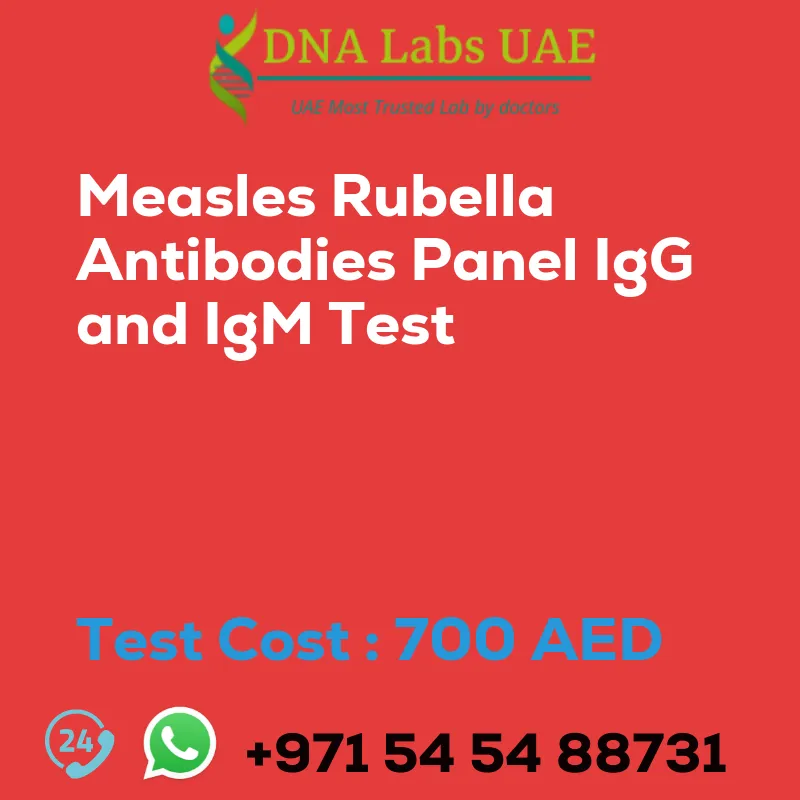 Measles Rubella Antibodies Panel IgG and IgM Test sale cost 700 AED