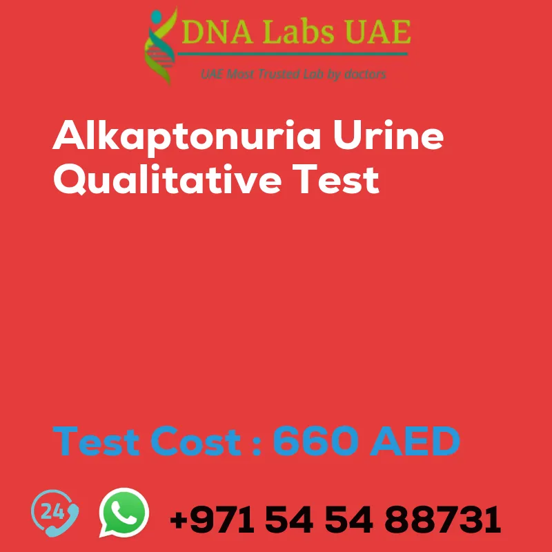 Alkaptonuria Urine Qualitative Test sale cost 660 AED