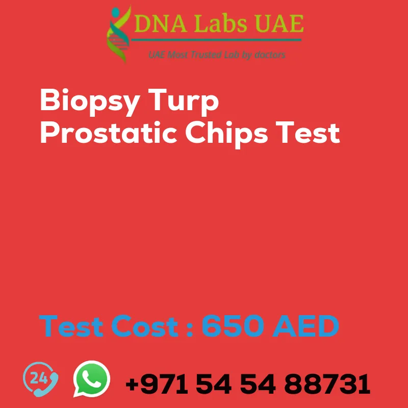 Biopsy Turp Prostatic Chips Test sale cost 650 AED