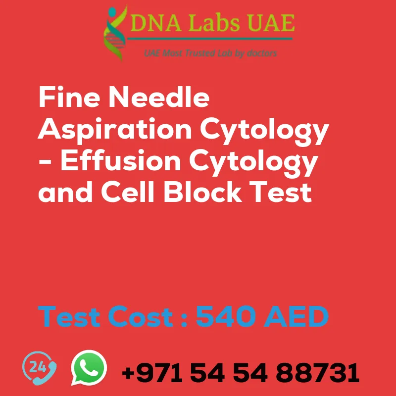 Fine Needle Aspiration Cytology - Effusion Cytology and Cell Block Test sale cost 540 AED