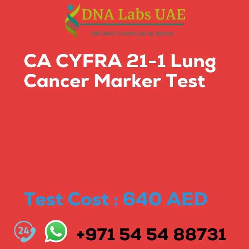 CA CYFRA 21-1 Lung Cancer Marker Test sale cost 640 AED