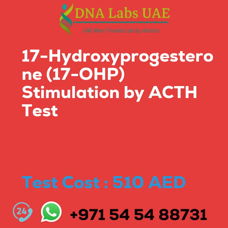 17-Hydroxyprogesterone (17-OHP) Stimulation by ACTH Test sale cost 510 AED