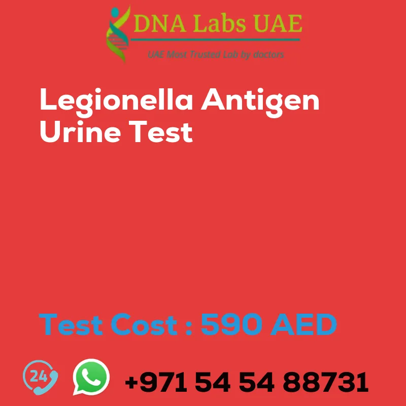 Legionella Antigen Urine Test sale cost 590 AED