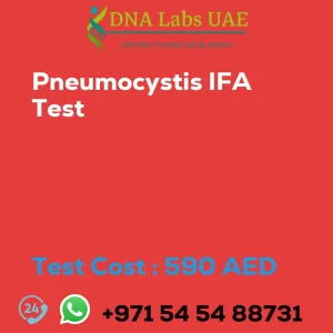 Pneumocystis IFA Test sale cost 590 AED