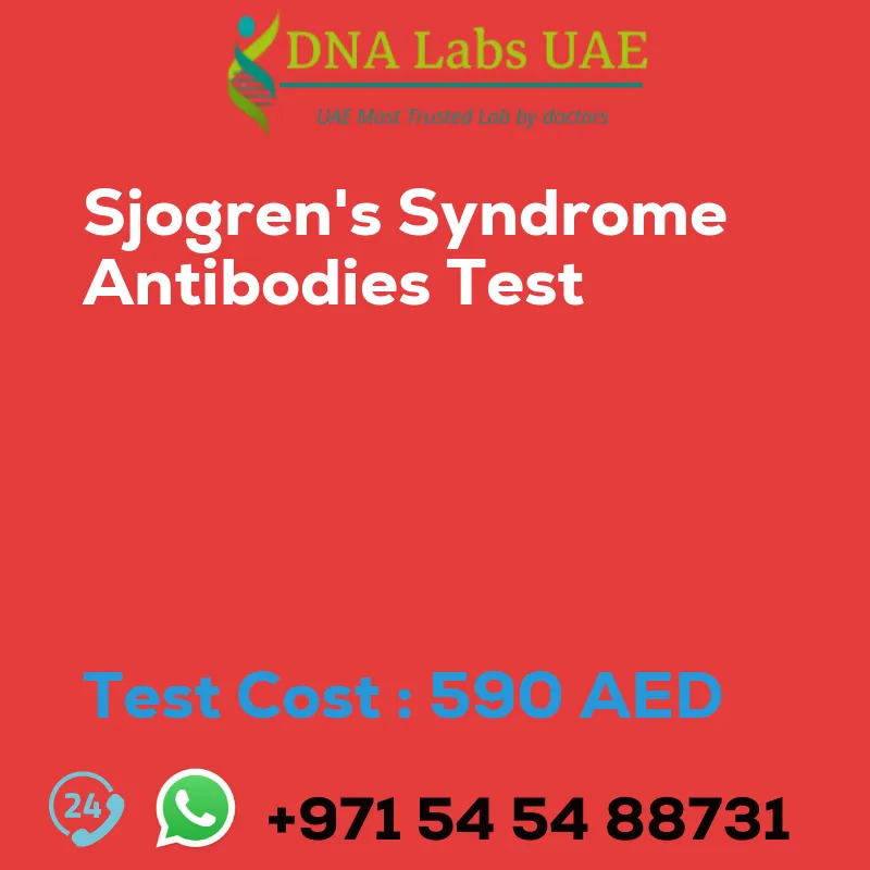 Sjogren's Syndrome Antibodies Test sale cost 590 AED