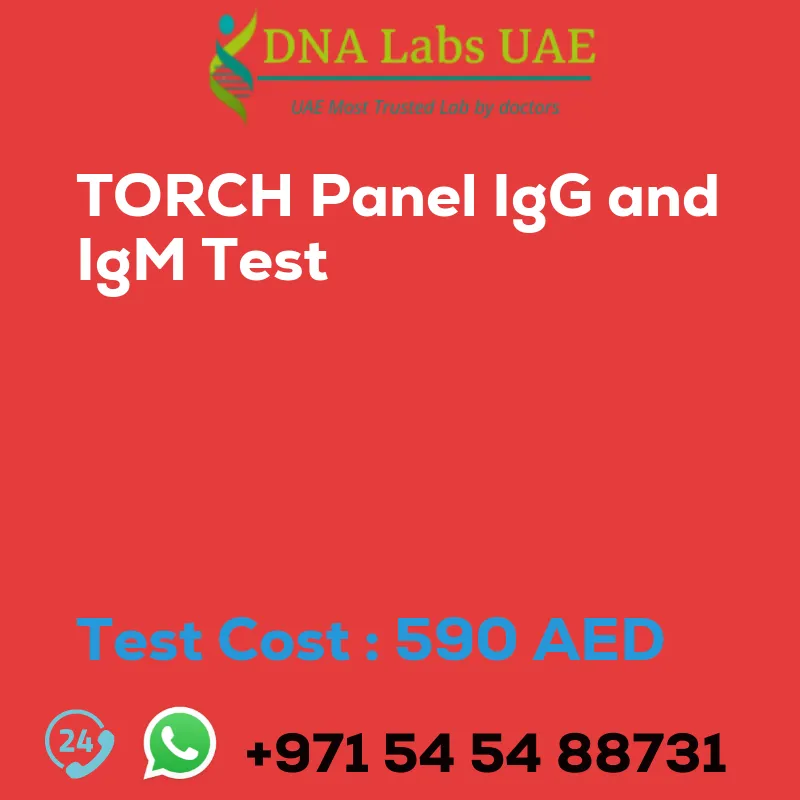 TORCH Panel IgG and IgM Test sale cost 590 AED