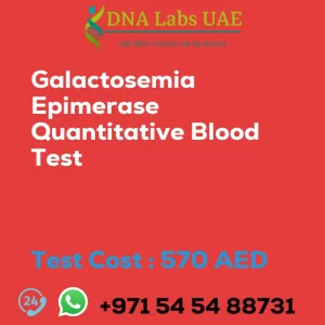 Galactosemia Epimerase Quantitative Blood Test sale cost 570 AED