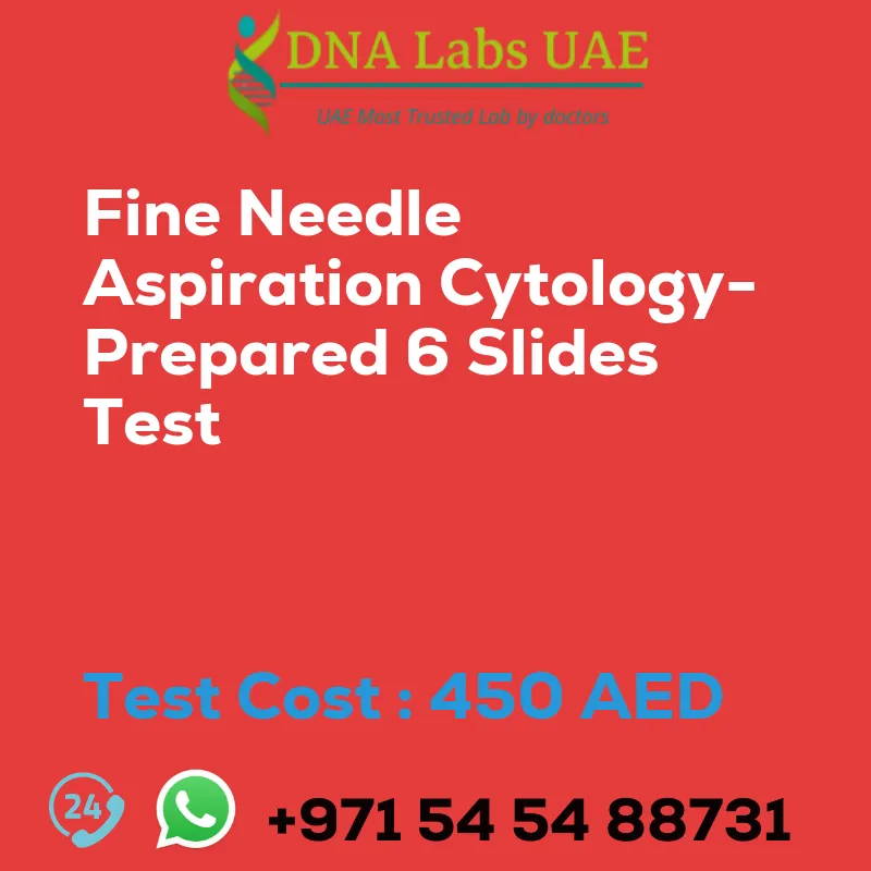 Fine Needle Aspiration Cytology- Prepared 6 Slides Test sale cost 450 AED
