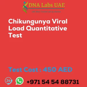 Chikungunya Viral Load Quantitative Test sale cost 450 AED