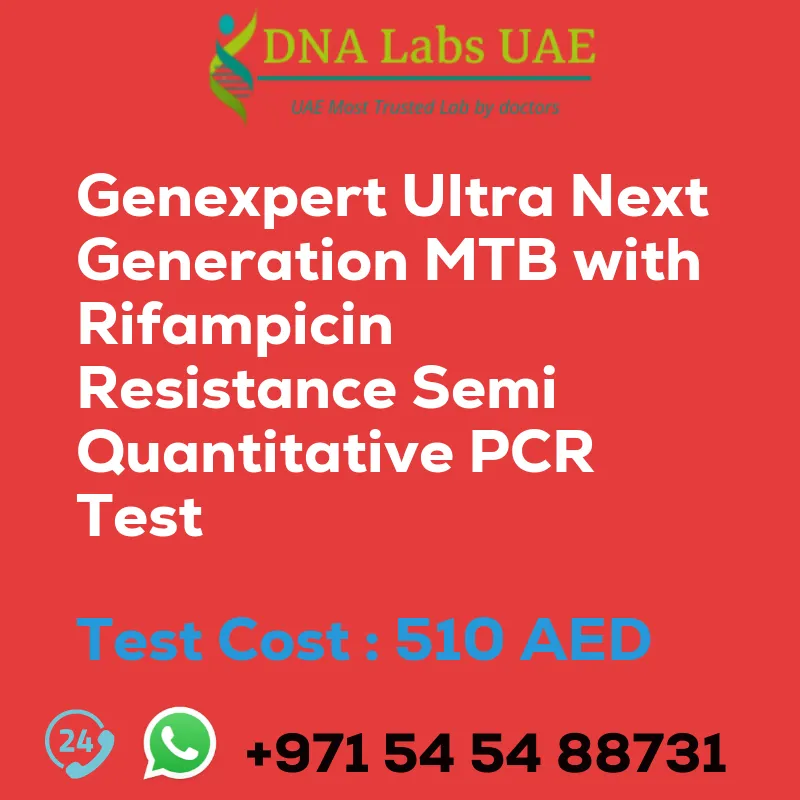 Genexpert Ultra Next Generation MTB with Rifampicin Resistance Semi Quantitative PCR Test sale cost 510 AED
