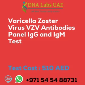 Varicella Zoster Virus VZV Antibodies Panel IgG and IgM Test sale cost 510 AED