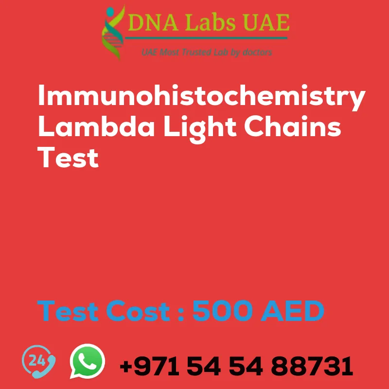 Immunohistochemistry Lambda Light Chains Test sale cost 500 AED