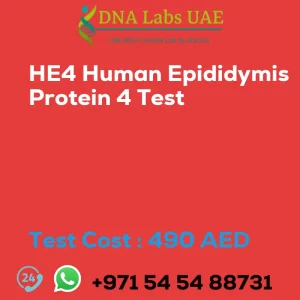 HE4 Human Epididymis Protein 4 Test sale cost 490 AED